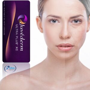 Juvederm Ultra XC Injection 7 1