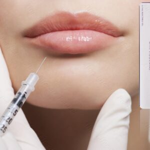 Juvederm Volbella Injection 19