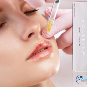 Juvederm Volbella Injection 20